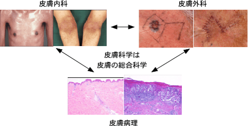 教授からのメッセージ - 東京大学皮膚科学教室